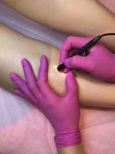 Elektroepilacja Anastasiia Baryshnina